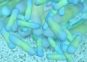 Legionella